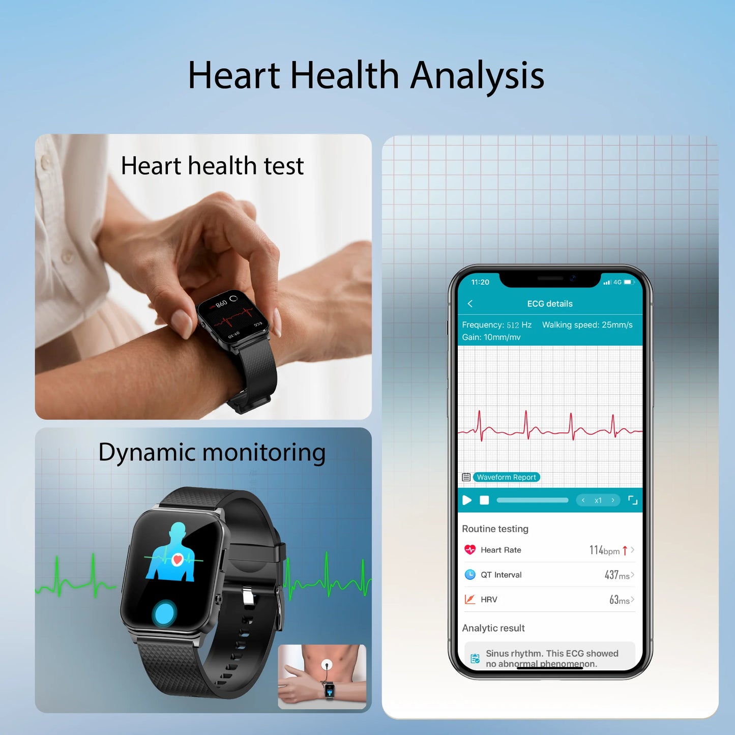 2025 New Smart Watch Men Women ECG Heart Rate Blood Pressure SpO2 Body Temperature Sleep Monitor Fitness Monitor Sports Watch