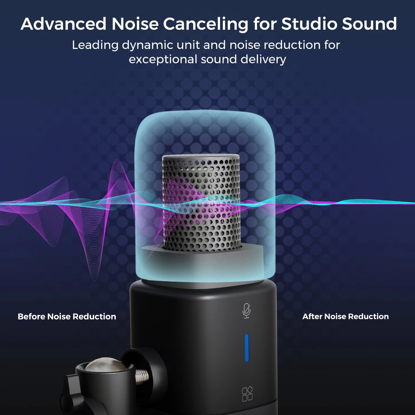 NearStream Professional Microphone Dynamic XLR USB Mic Desktop US Local Shipping Plug-and-Play for Gaming Studio Streaming